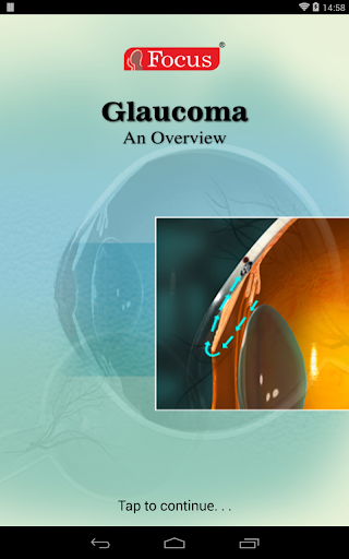 Glaucoma-An Overview