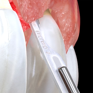 Periodontal Advanced Surgery logo