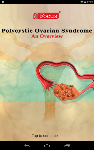 Polycystic ovarian syndrome