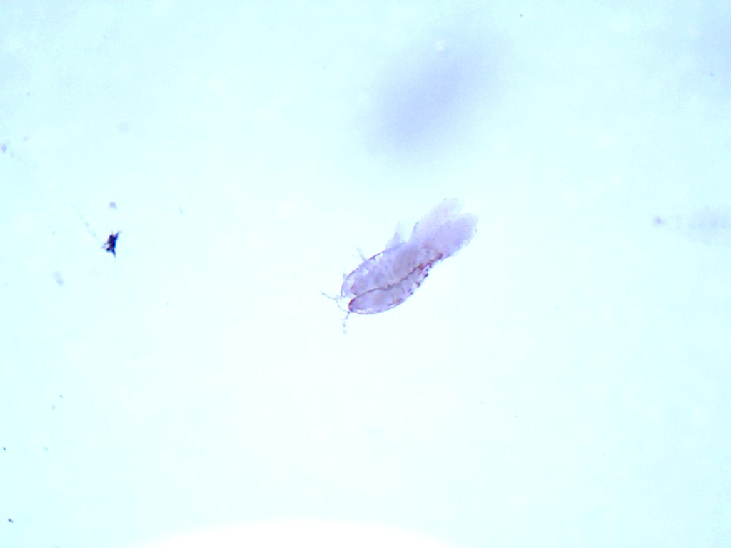 copepod with eggs