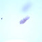 copepod with eggs