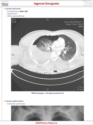 【免費醫療App】SMARTfiches Urgences Chir-APP點子