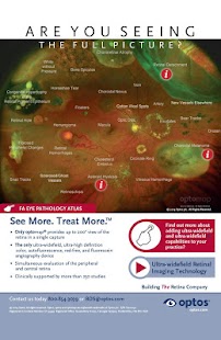 optomap® UWF™ retinal imaging Screenshots 0