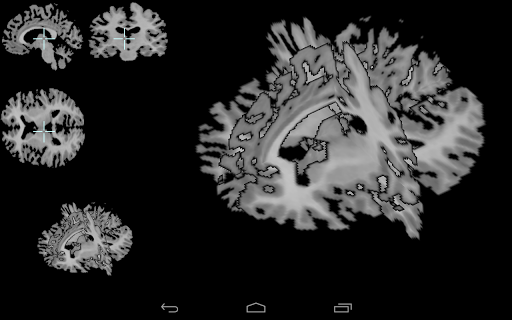 Brain viewer