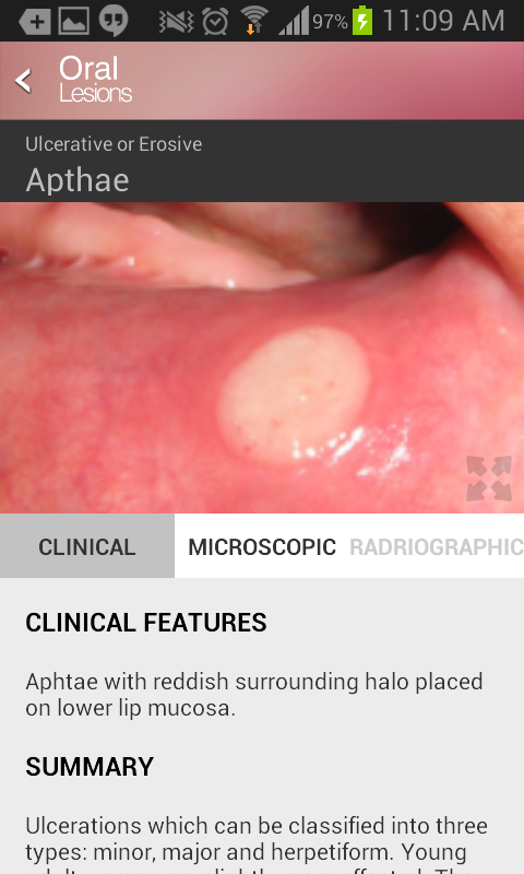 Oral Lesions Screen 3