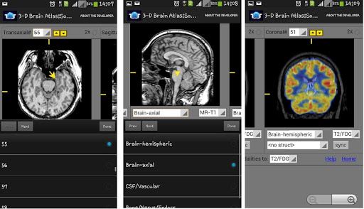 3-D brain Atlas