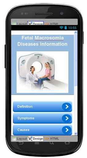 Fetal Macrosomia Information