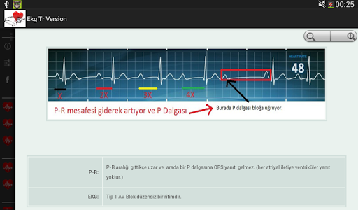 【免費醫療App】EKG TÜRKÇE-APP點子