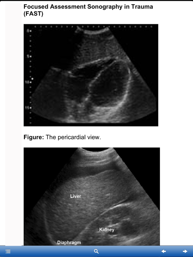    Advanced Trauma Life Support- screenshot  