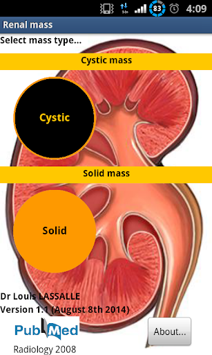 Renal Mass - Bosniak