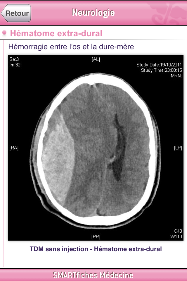 SMARTfiches Neurologie Screen 2