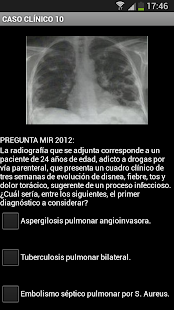 How to download Radiografía Tórax (Radiología) patch 1.3 apk for pc