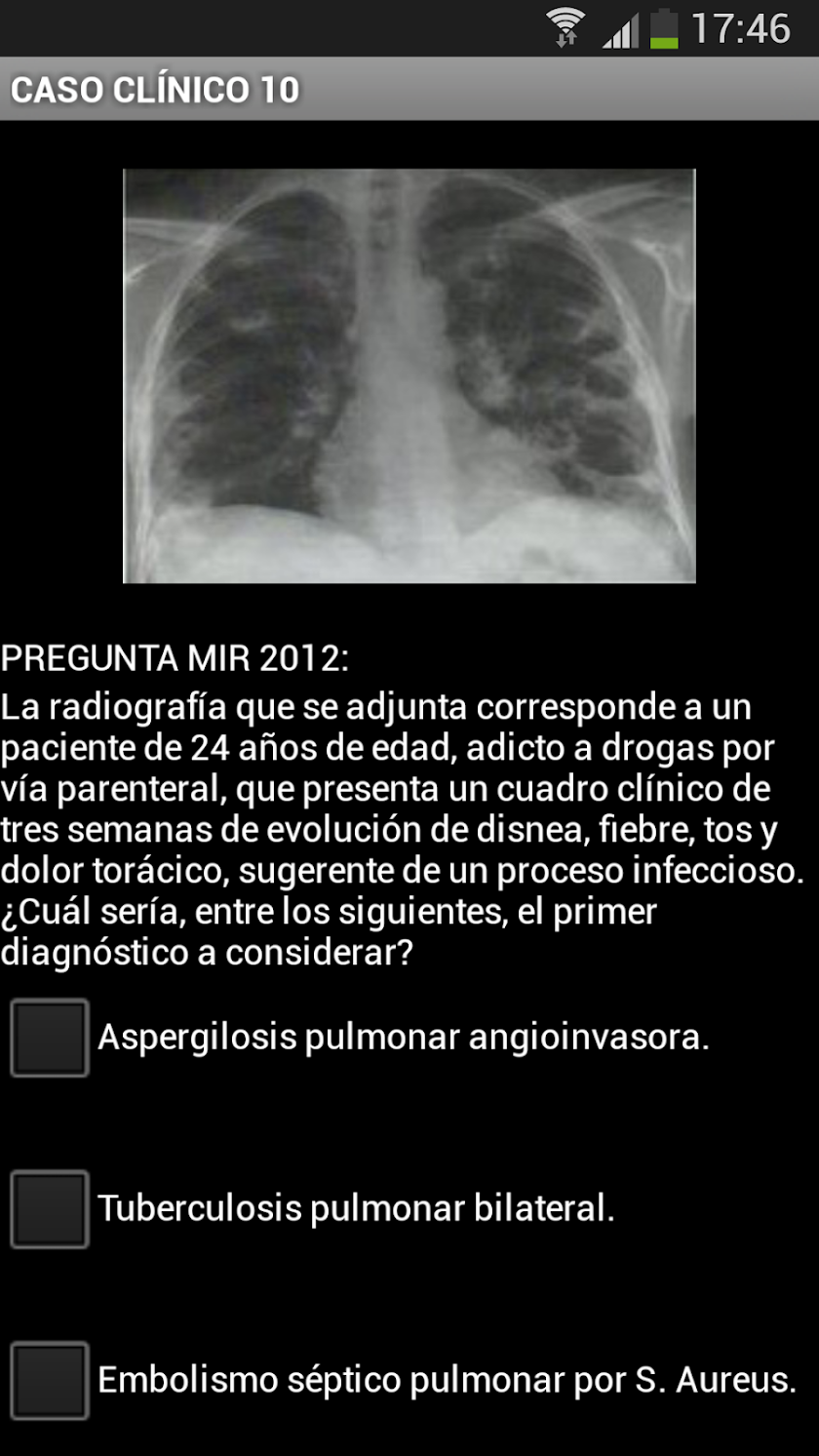 Radiografía Tórax (Radiología) Screen 3