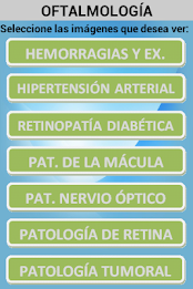 ophthalmology poster 8
