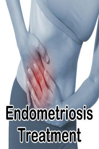 Endometriosis Treatment