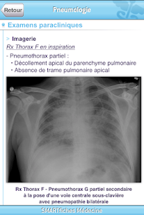 How to mod SMARTfiches Pneumologie Free 1.08 mod apk for android