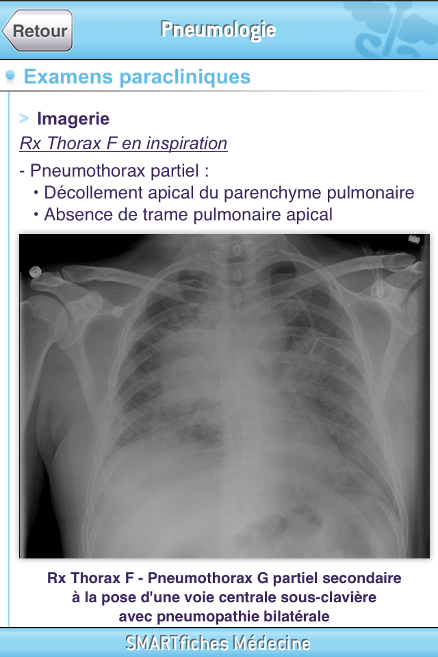 SMARTfiches Pneumologie Free Screen 2