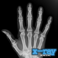 X-Ray Scanner Illusion Unlock Apk