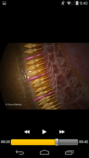 Free Ophthalmology -Pocket Dict. APK for Android