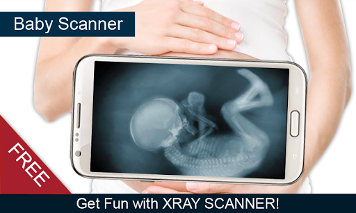 Baby X-Ray Scanner Prank