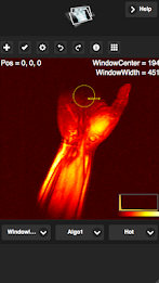Simple Dicom Viewer poster 1