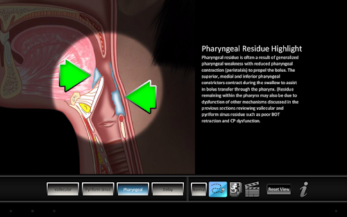 Android application Swallowing Residue screenshort