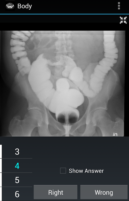 Android application Radiology Flashcards: Body screenshort