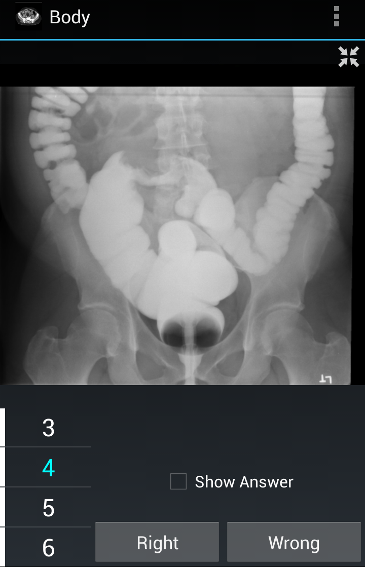 Radiology Flashcards: Body Screen 1