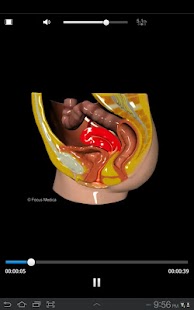 Download Gynecology-Animated Dictionary APK