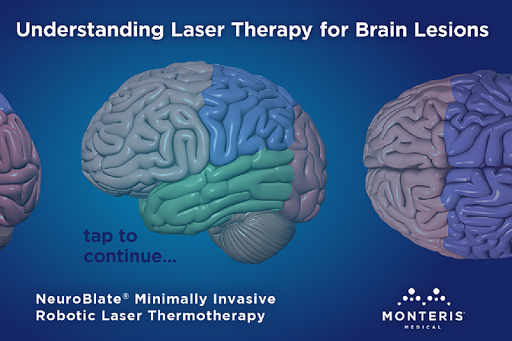 Laser Therapy - Phone Version