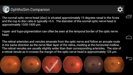 免費下載醫療APP|OphthoSim Companion app開箱文|APP開箱王