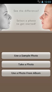 Rhinoplasty with Dr. Portuese - náhled