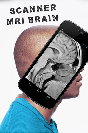 扫描脑部MRI