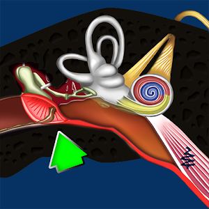 Otitis Media