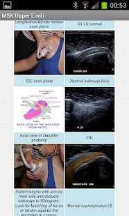 How to download MSK ultrasound Upper Limb lastet apk for bluestacks