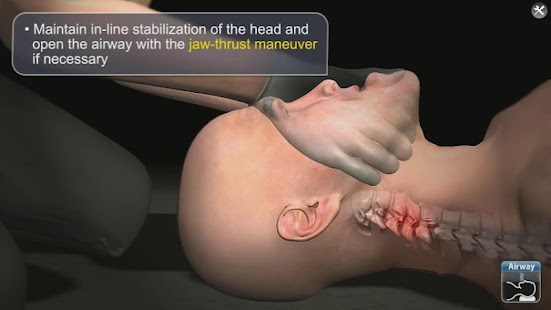 How to mod Medrills: Spinal Cord Injury lastet apk for bluestacks