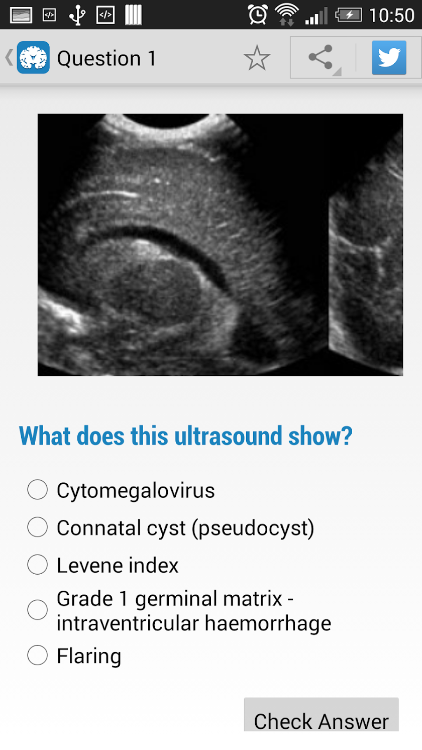 Cranial Ultrasound Screen 2