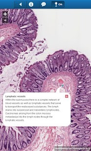 smart Histology Lite Screenshots 2