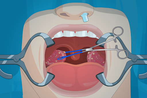 【免費模擬App】Operate Now: Tonsil Surgery-APP點子