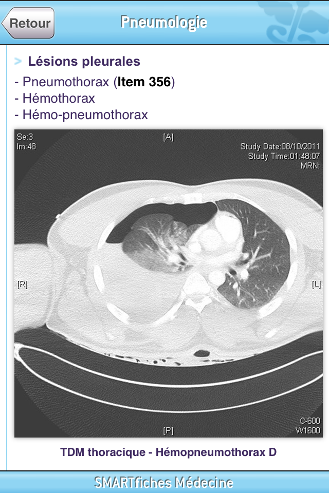 SMARTfiches Pneumologie Screen 3