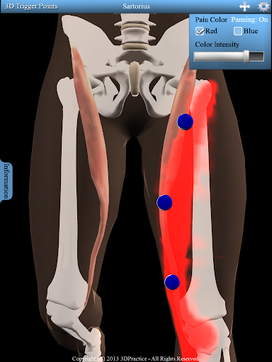 【免費醫療App】3D Trigger Points-APP點子