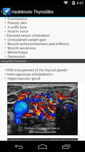How to install Ultrasound by iSonographer lastet apk for bluestacks