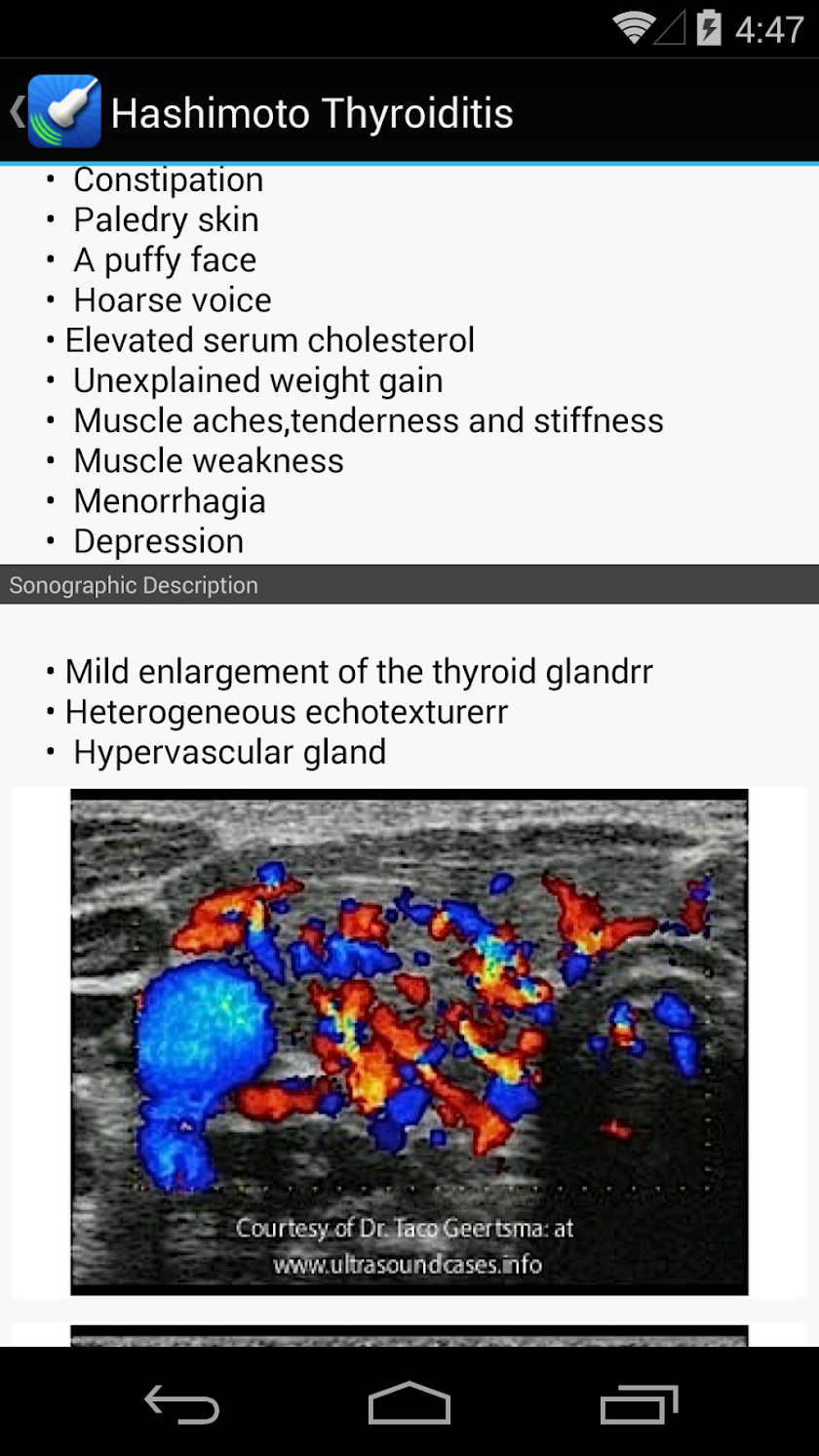Ultrasound by iSonographer Screen 2