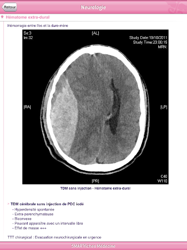 【免費醫療App】SMARTfiches Neurologie Free-APP點子