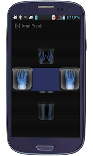 Xray- Prank Screenshots 2