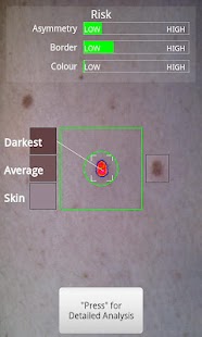 Doctor Mole - Skin cancer app