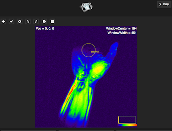 Simple Dicom Viewer poster 6