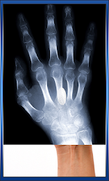 Xray Scanner Camera poster 6