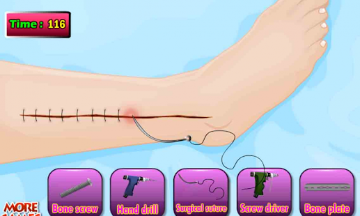 download Dokter Tom Leg Bedah Permainan free