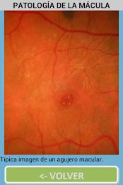 ophthalmology poster 10